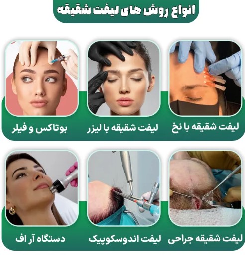 روش‌های لیفت شقیقه در سال ۱۴۰۴