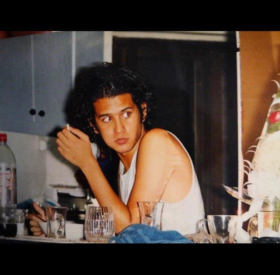 سیاوش خیرابی قبل از عمل بینی